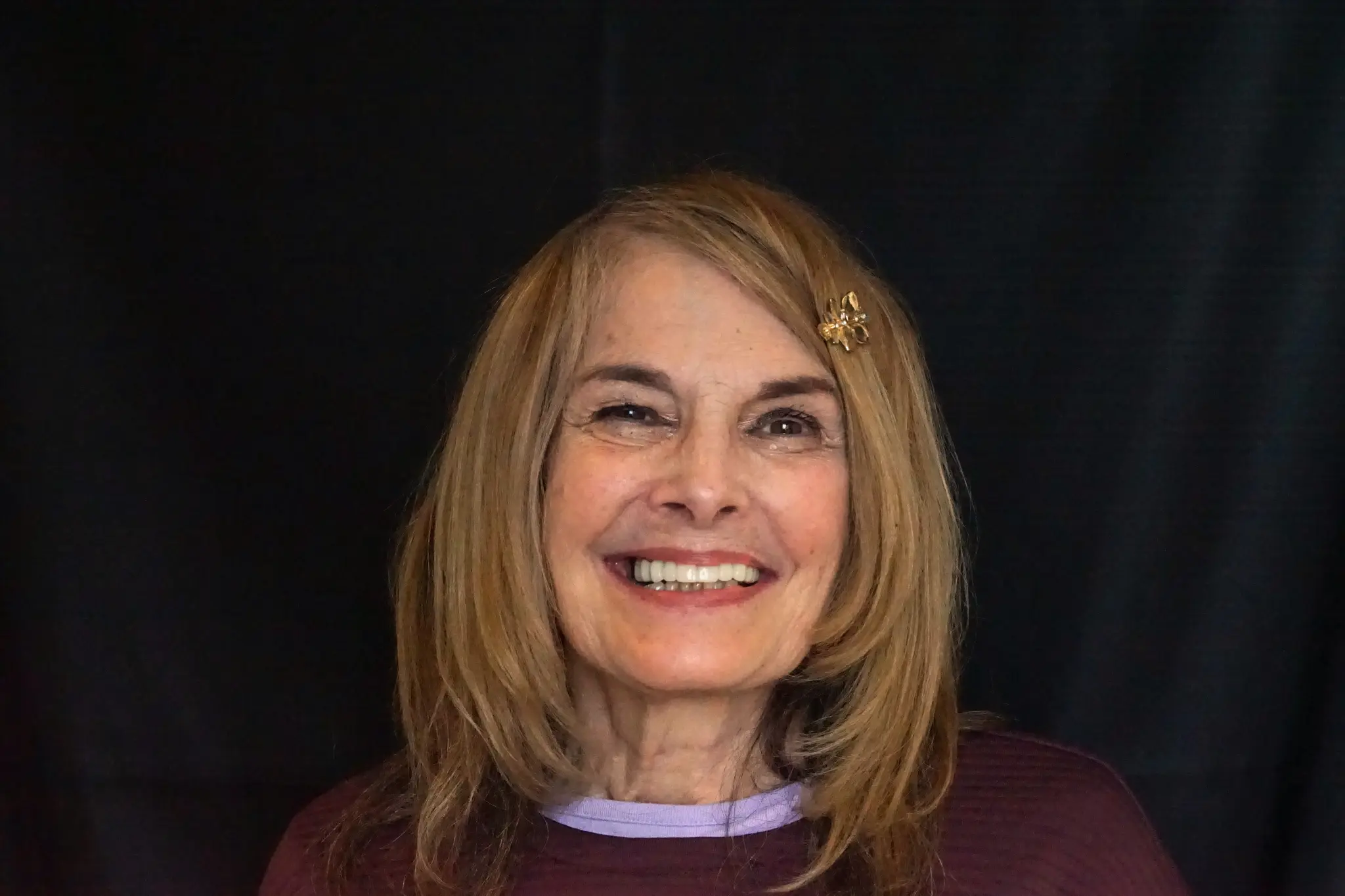 After All-on-X treatment - beautiful new smile