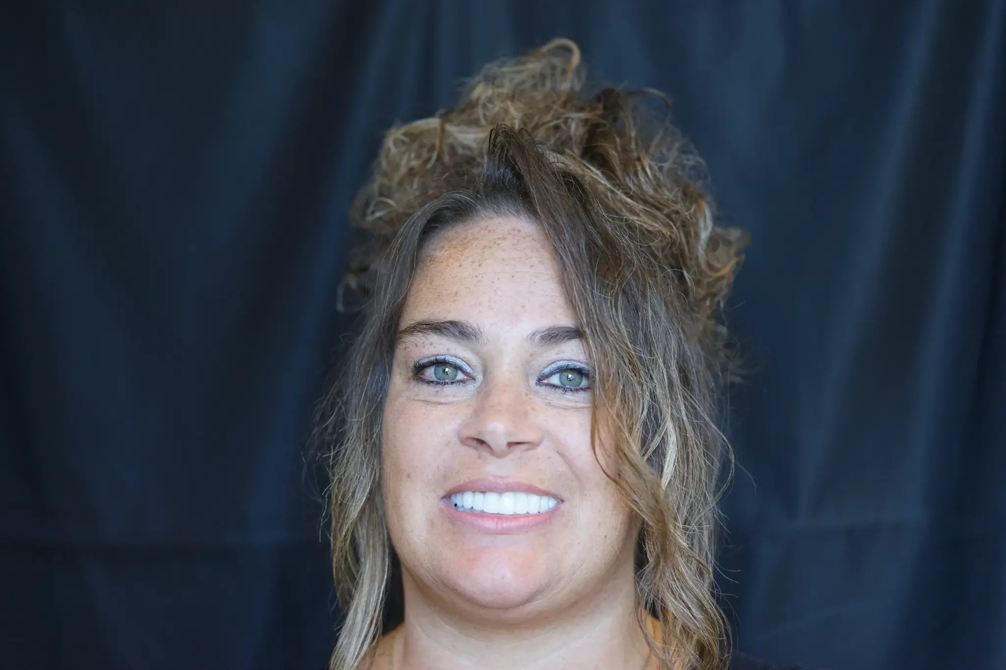 After All-on-X treatment - perfect smile restoration